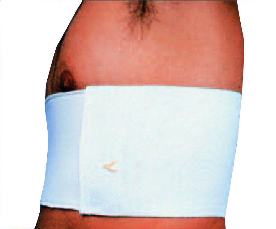 Rippengürtel, Bandage, Rippenstütze