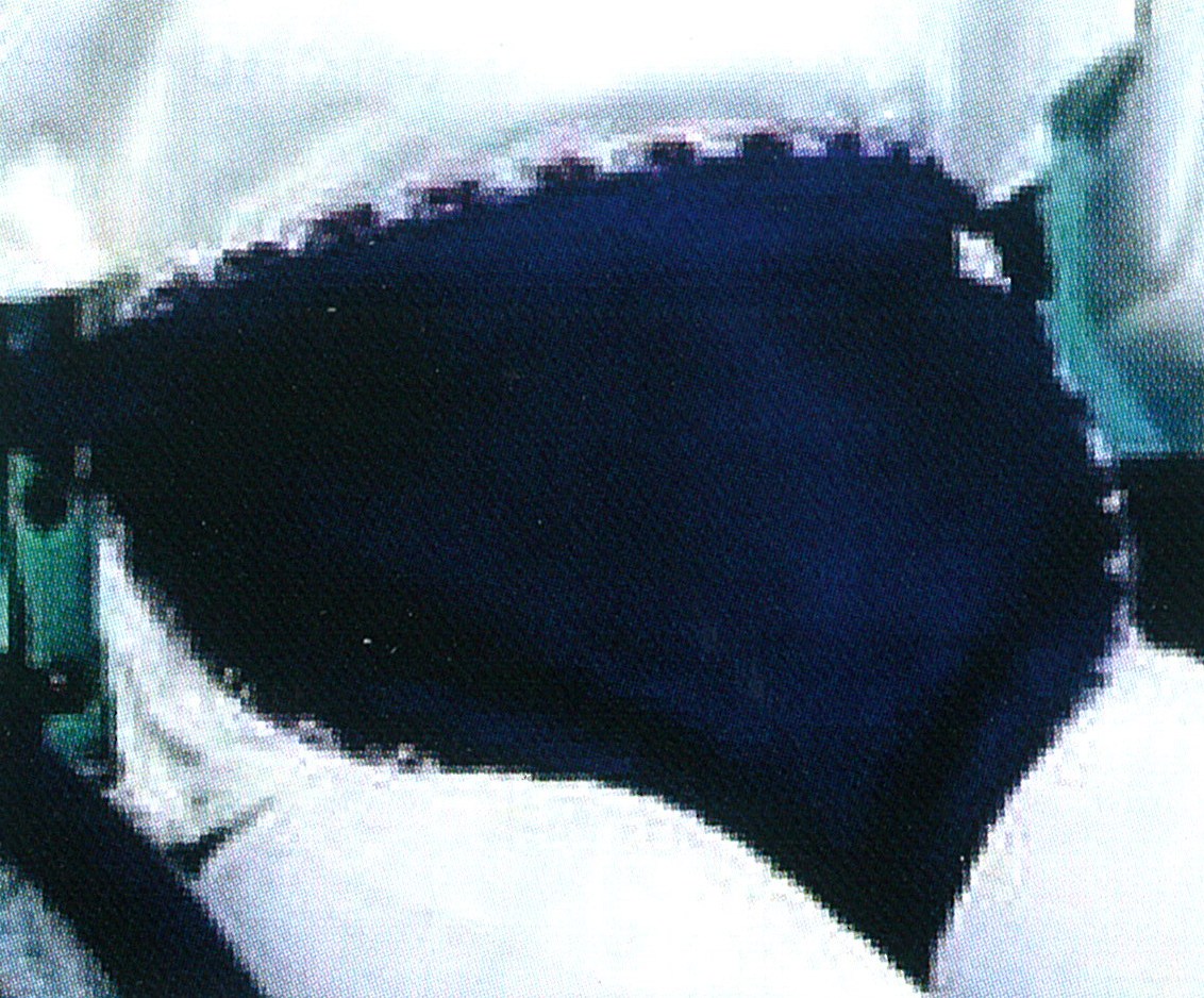 Beckengurt "Arpegia“, Positionierungsgurt