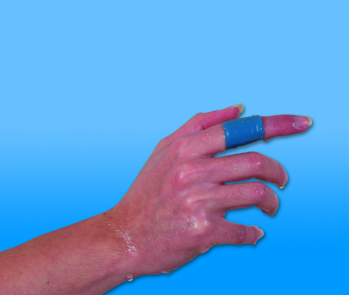RUDADETEC Pflasterstrips -  Fingerkuppenpflaster, Pflaster