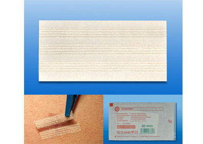 RUDASTRIP® steril Wundnahtstreifen, Streifenpflaster, Wundpflaster,