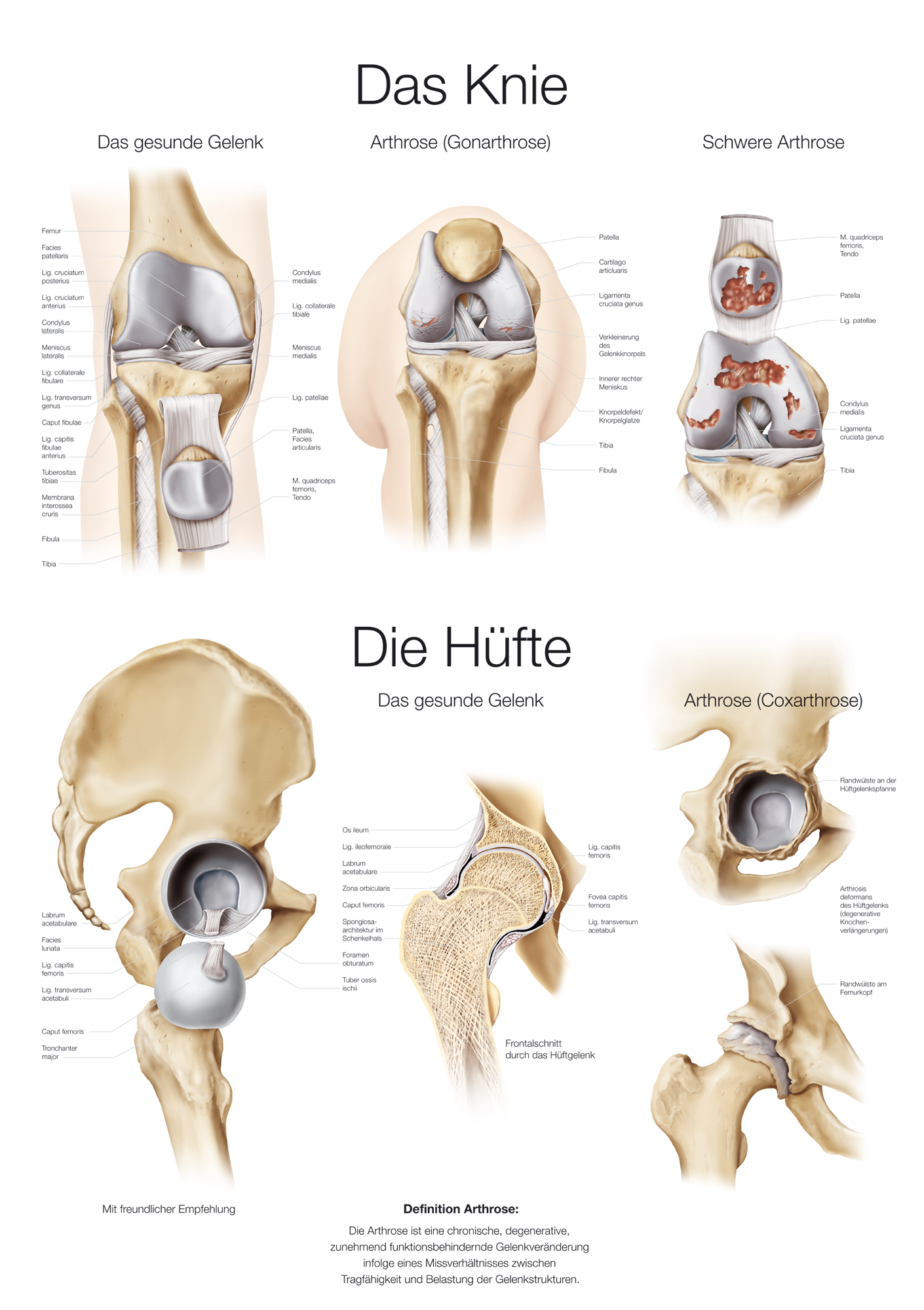 Anatomische Lehrtafel  Das Knie/Die Hüfte, Anatomieposter, Anatomietafel